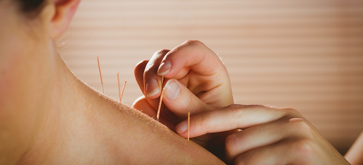 skulder akupunktur beskaaret